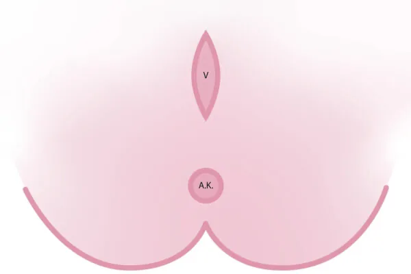 Illustration zur pelvioanalen Rekonstruktion